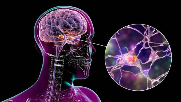 Estimulación cerebral