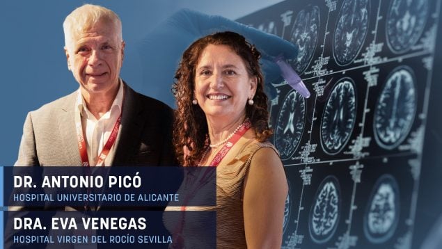 Historias de ‘gigantes’: «Hacia un tratamiento más humano y efectivo de la acromegalia»