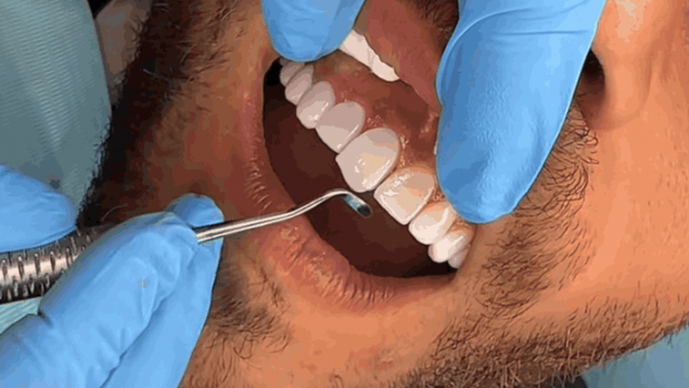 turismo dental en Marruecos