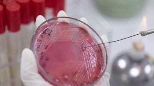 Bacterias