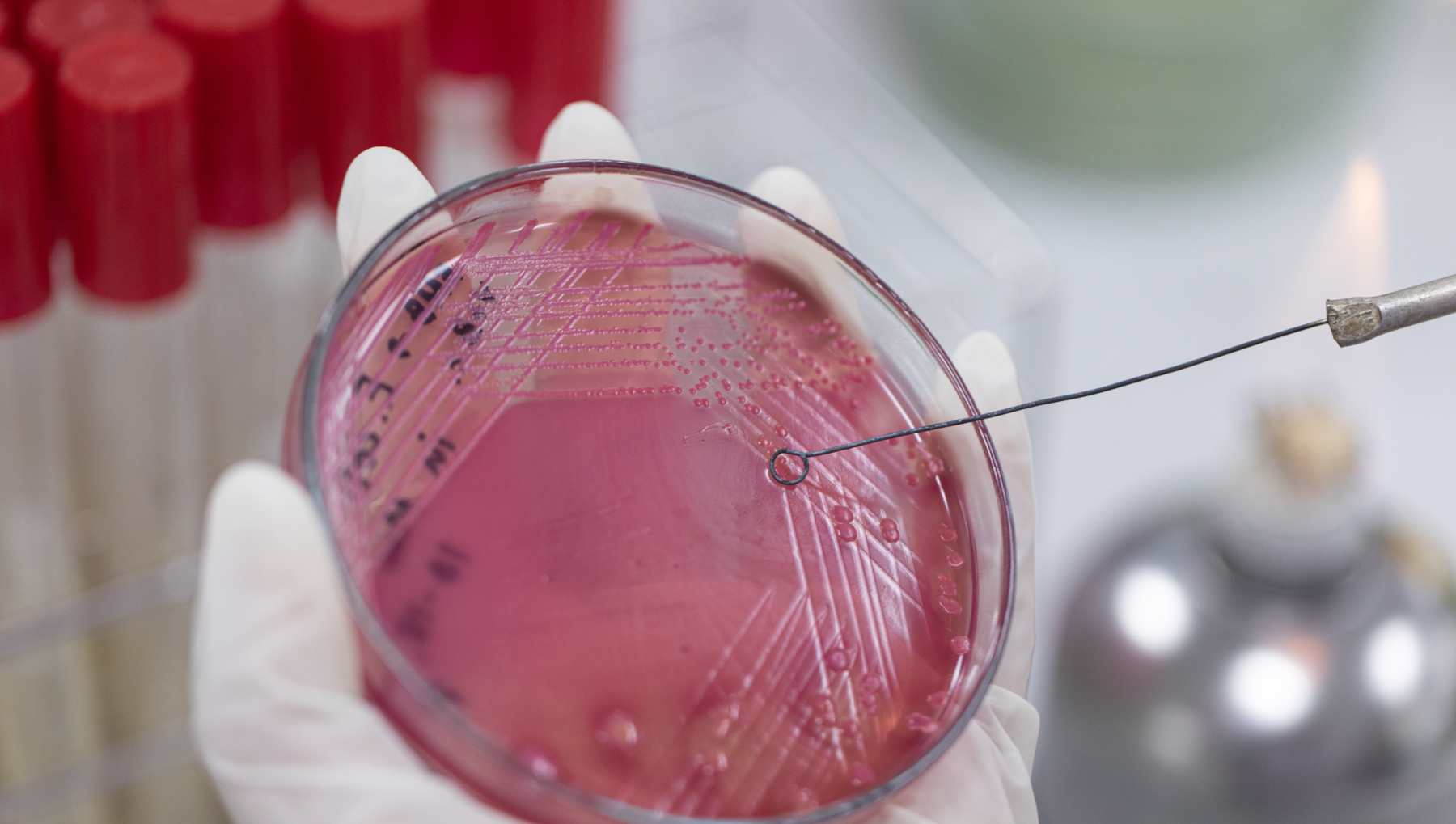 Bacterias resistentes.