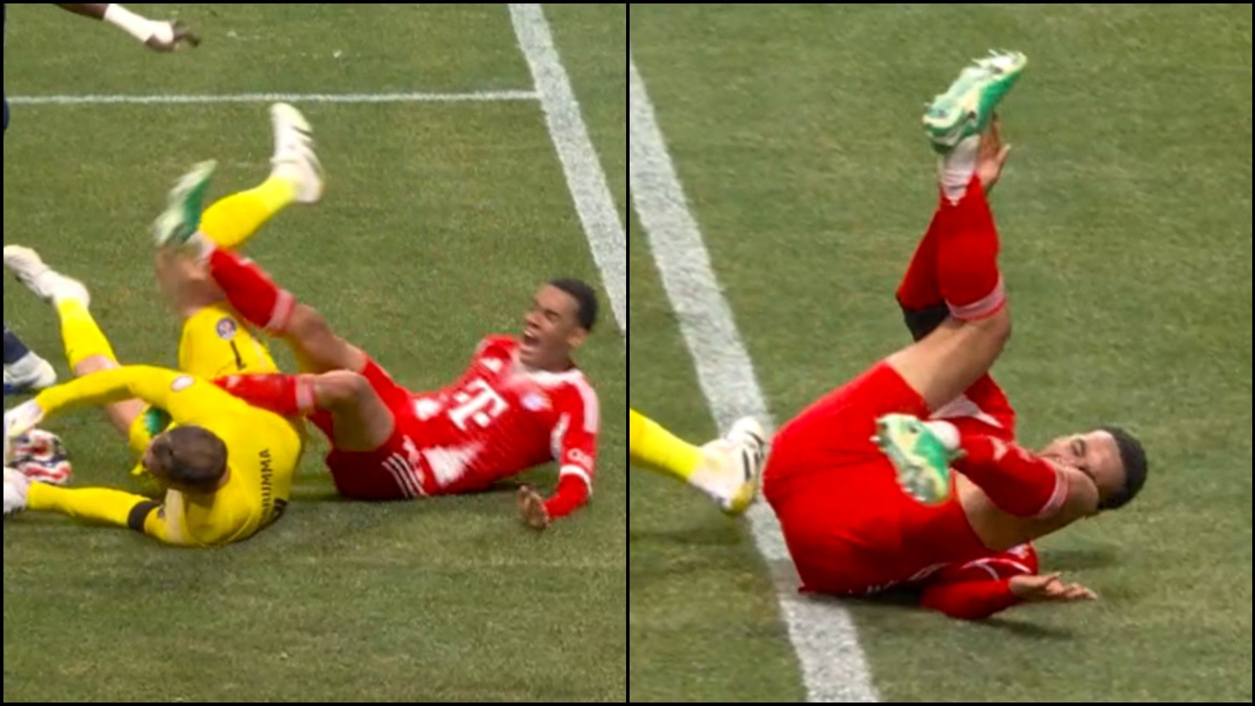 Imagen de la acción en la que Jamal Musiala se lesiona de gravedad. (DAZN)
