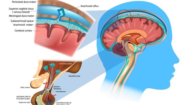 12 de Octubre tumor meninge