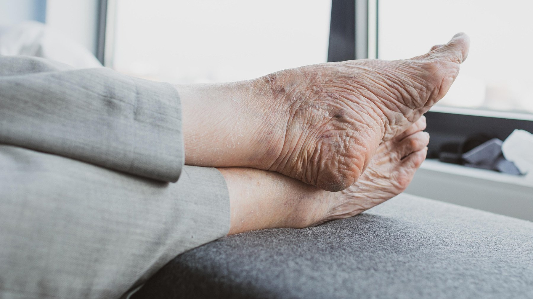 Pies de adulto mayor. Foto: Pixabay.