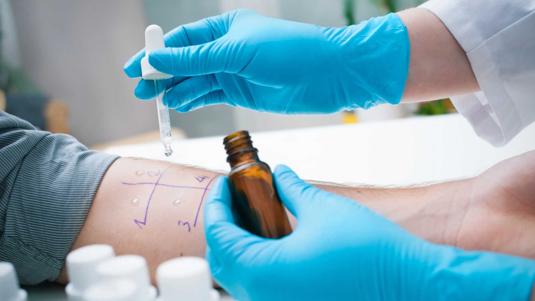 Test para diagnosticar el tipo de alergia.