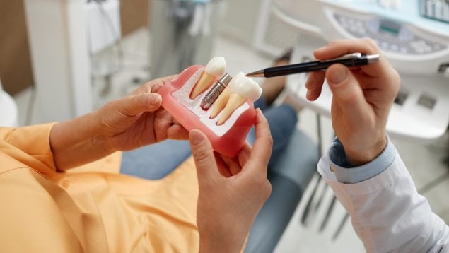 ¿Qué hacer si pierdes un implante dental?