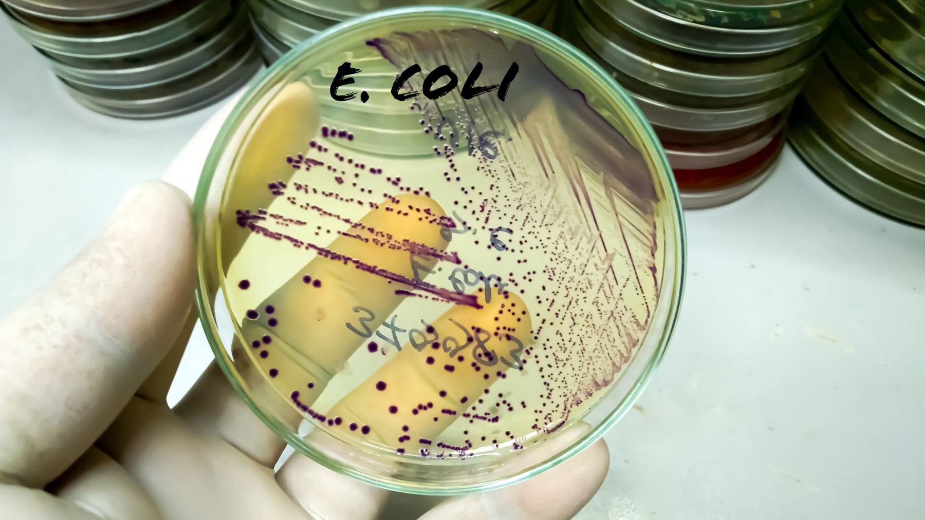 La UE mide el nivel de escherichia coli en las aguas de baño para garantizar la seguridad y la calidad de las mismas.