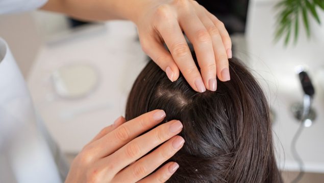 caspa, la dermatitis seborreica y la psoriasis en verano