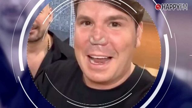 Lucas, el cantante de Andy y Lucas, reaparece con nuevo cambio en su nariz (Atresmedia).