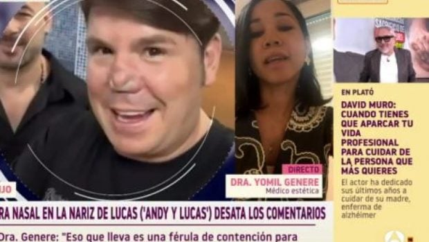 Una doctora explica qué le ha pasado, otra vez, a la nariz del cantante Lucas, de Andy y Lucas (Atresmedia).