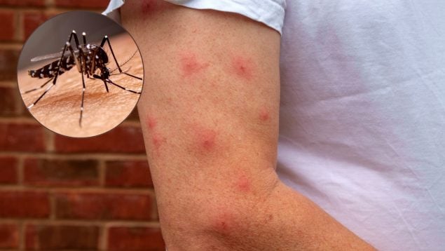 Los mosquitos