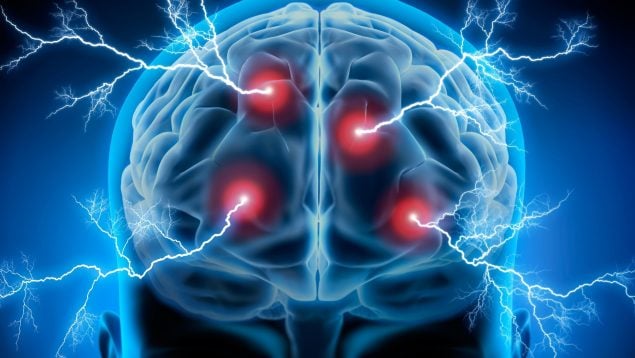 Envejecimiento cerebral
