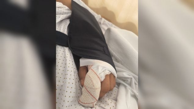 Un toxicómano sufre un brote psicótico y arranca un dedo de un mordisco a un guardia civil en Almería