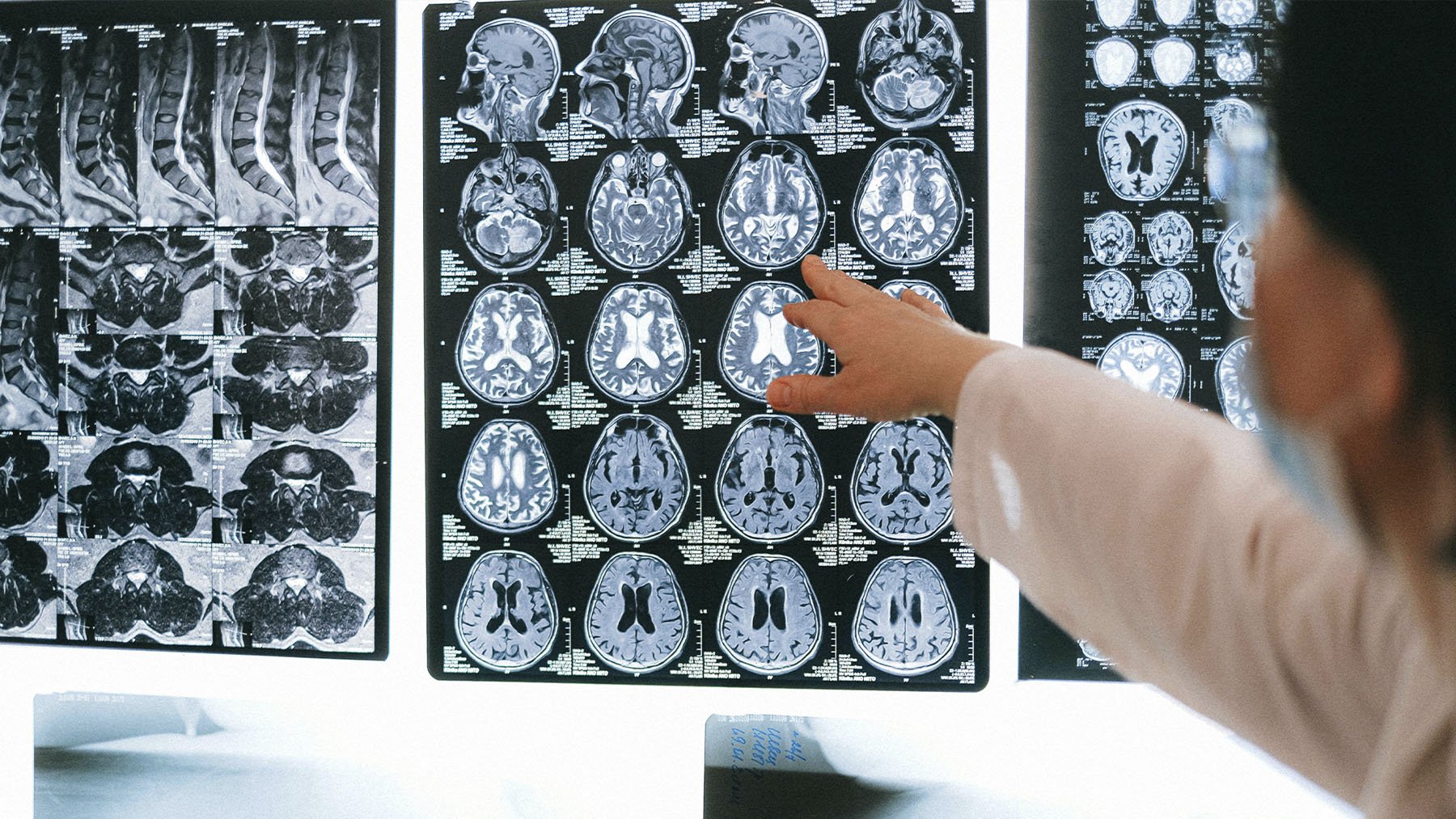 Ya es oficial: algunas personas de 80 años tienen el cerebro de una de 50, y los científicos ya saben por qué