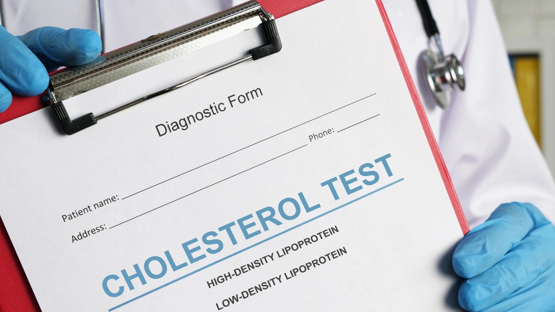 Colesterol alto: éstas son las señales clínicas que no debemos ignorar