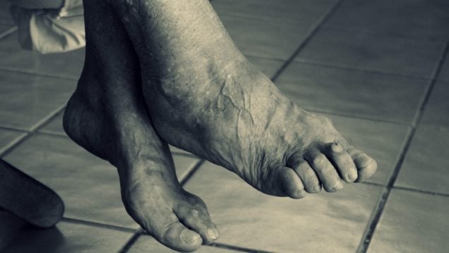 Cómo reducir la hinchazón en los pies, mejores métodos para reducir edemas en personas mayores de 65 años, reducir pies hinchados en tercera edad, uso de medias de compresión, beneficio de las medias de compresión en ancianos.