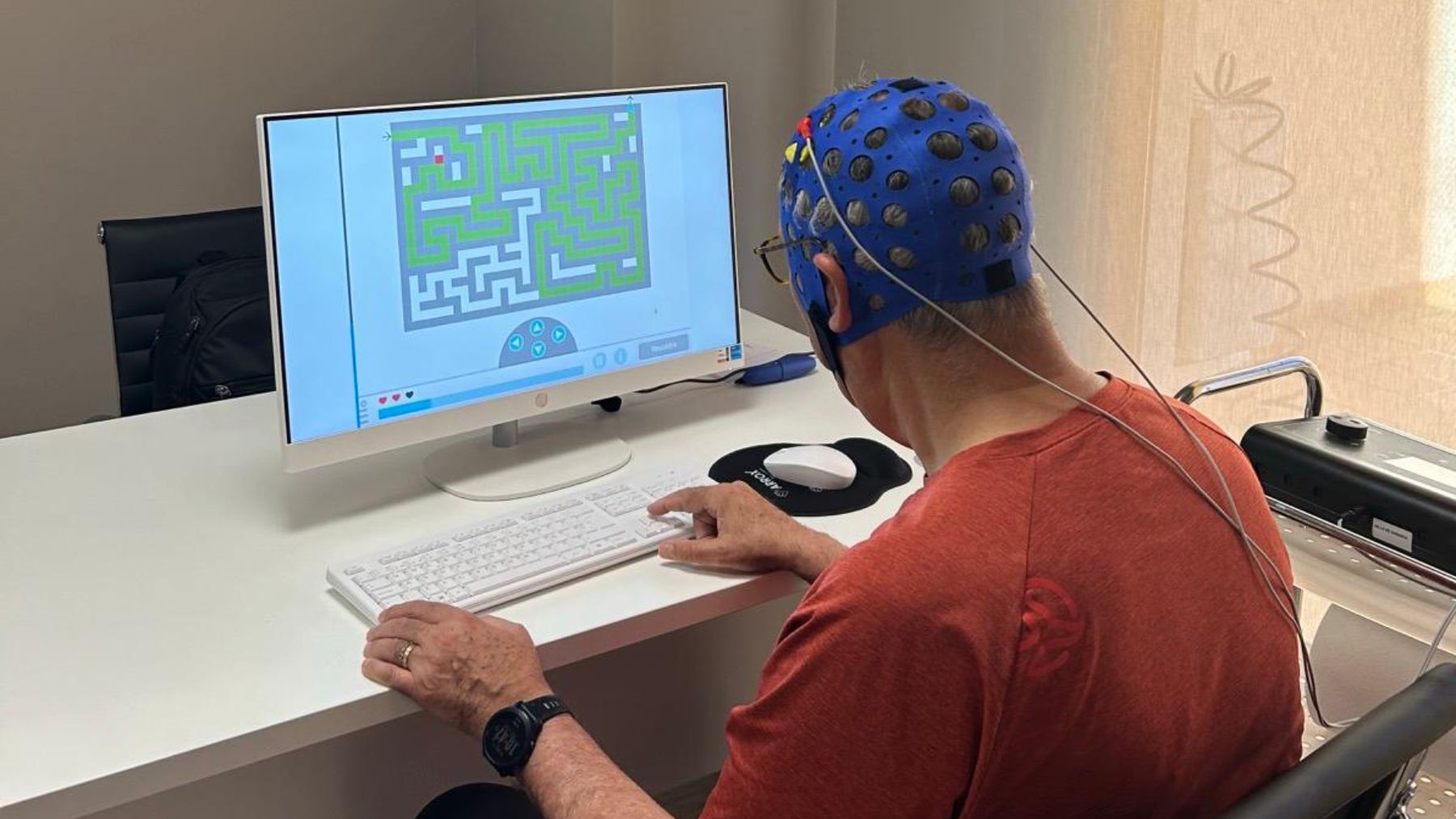 Oportunidades terapéuticas de la estimulación cerebral no invasiva en alzheimer
