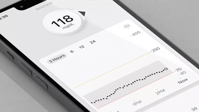 Dexcom glucosa