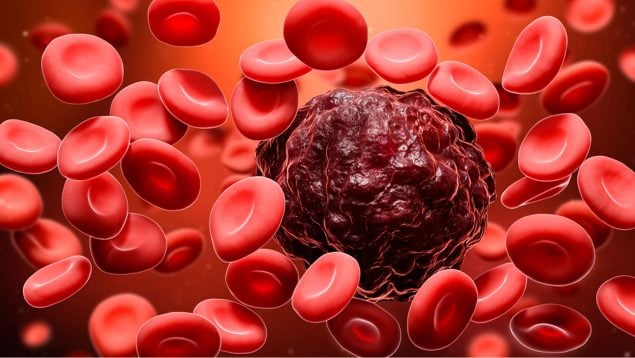 cáncer sangre