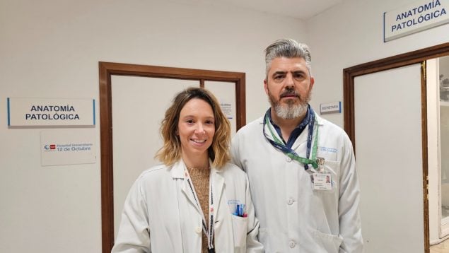 Alzheimer tumores cerebdrales