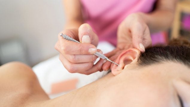 auriculoterapia