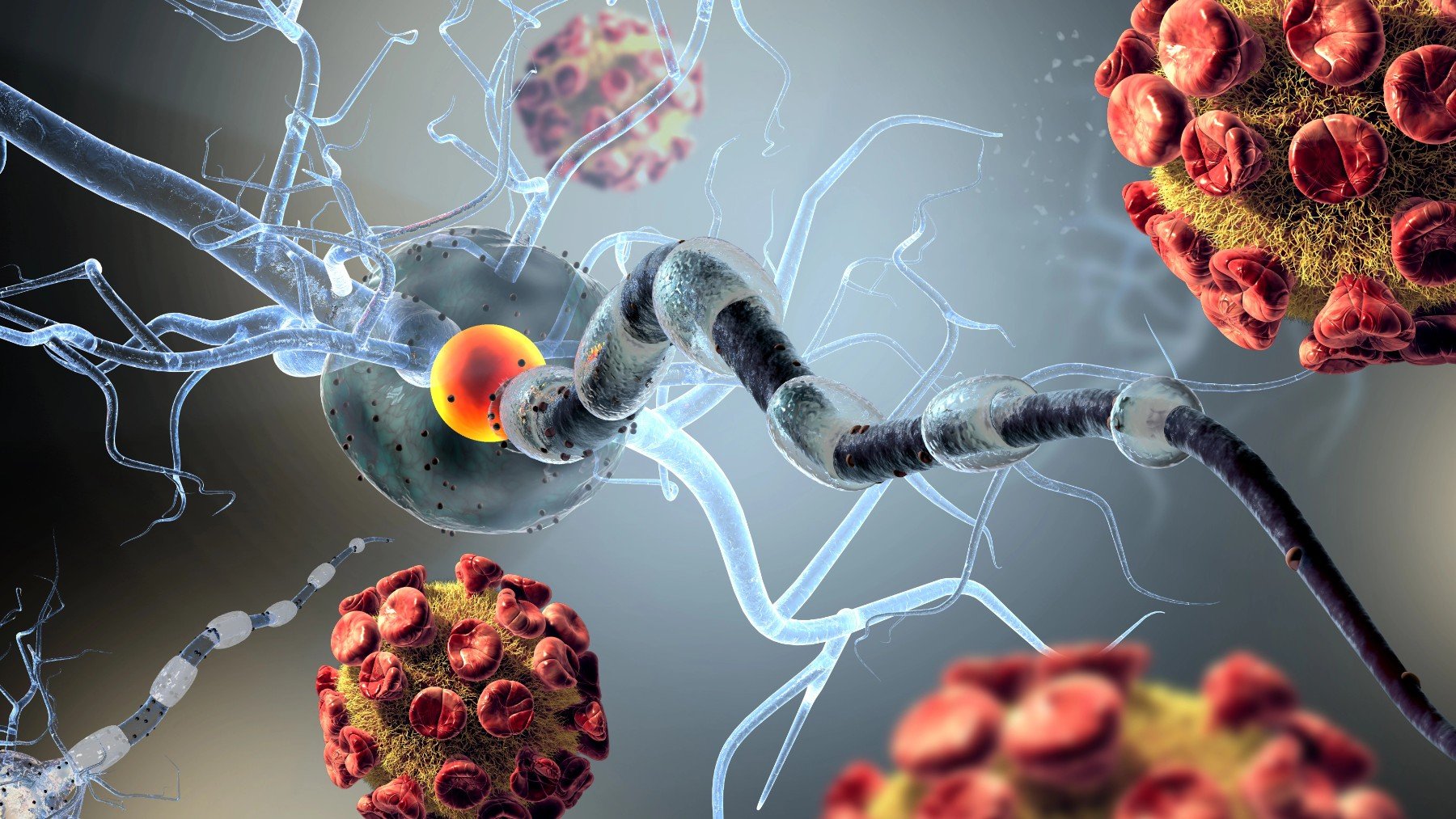 Científicos logran revertir el Alzheimer usando nanopartículas que viajan por el sistema vascular