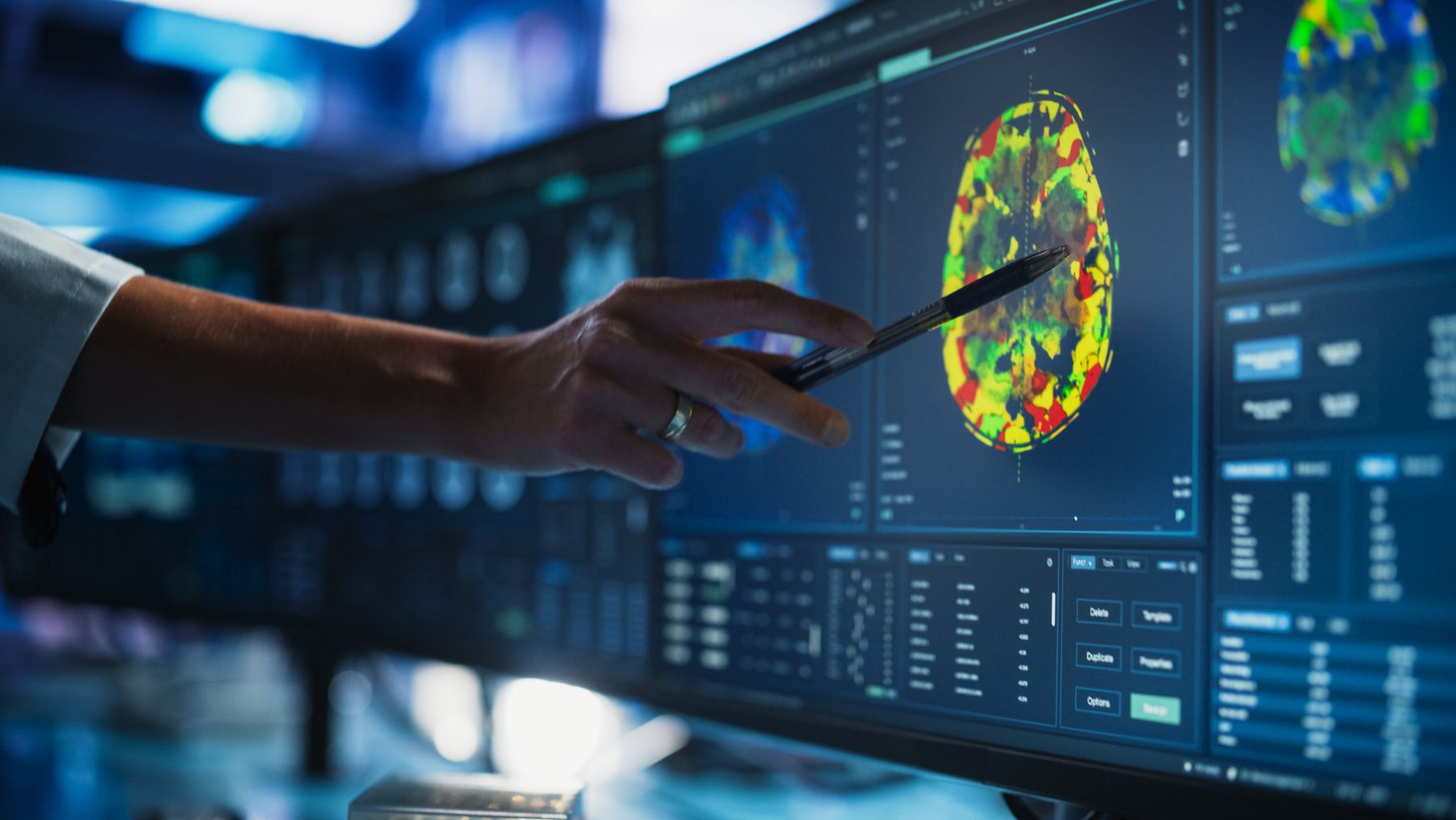 Un investigador observa la imagen de un cerebro.