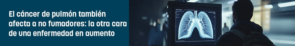 El cáncer de pulmón también afecta a no fumadores: la otra cara de una enfermedad en aumento