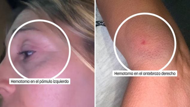 Agresión madre e hijo autista