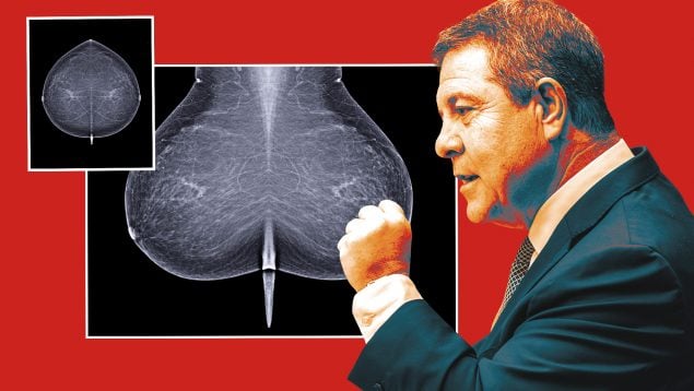 Page, mamografías, Castilla-La Mancha