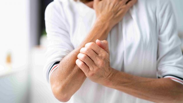 Psoriasis: una enfermedad visible que va mucho más allá de la piel