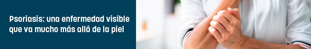 Psoriasis: una enfermedad visible que va mucho más allá de la piel