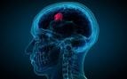 Con paso lento, pero firme: así avanza España en la investigación de tumores cerebrales