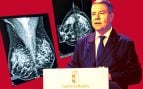 Crece el escándalo de las mamografías de Page: decenas de mujeres esperando desde marzo también en Toledo