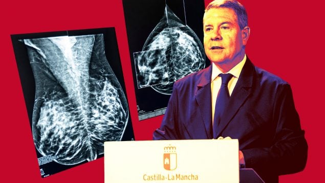 Crece el escándalo de las mamografías de Page: decenas de mujeres esperando desde marzo también en Toledo