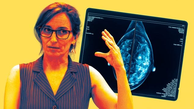 Mónica García mamografías