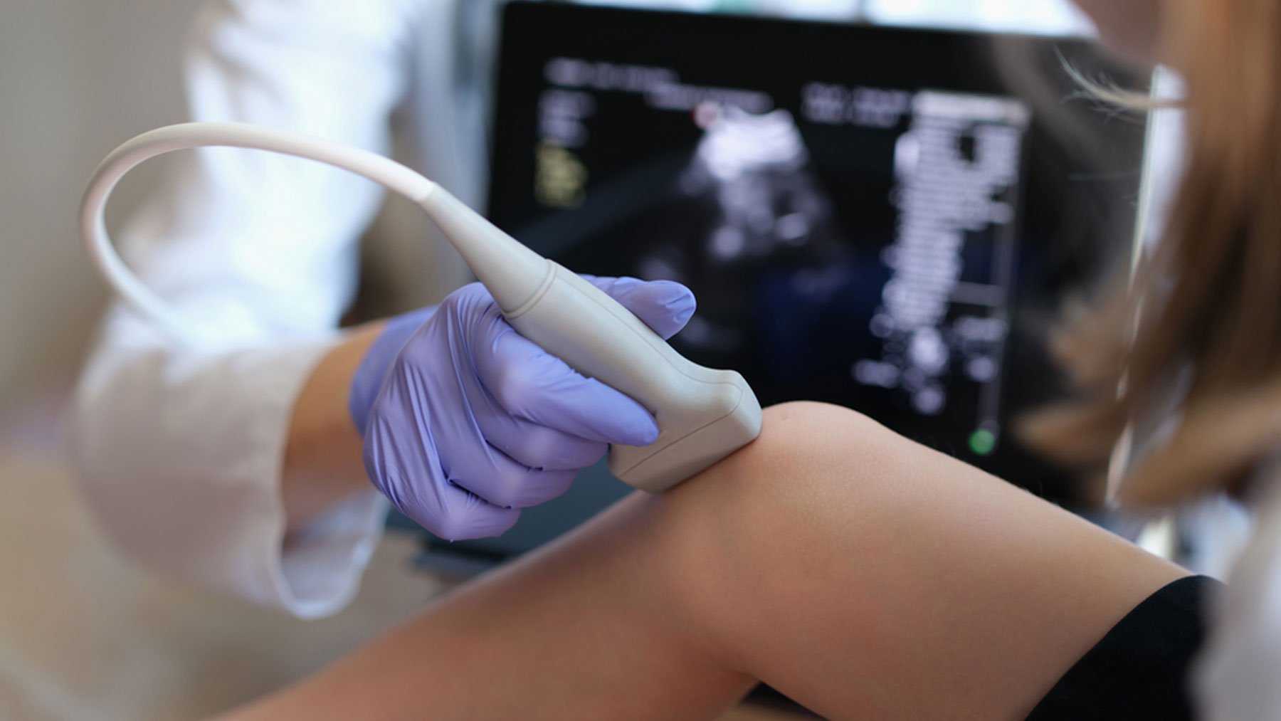 Fármacos contra el dolor ralentizan el avance del cáncer de huesos