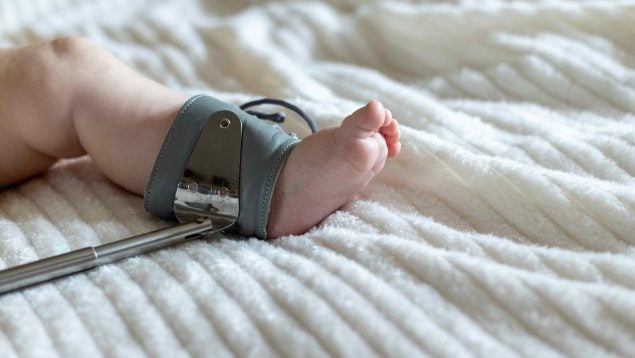 El diagnóstico precoz de la displasia de cadera en niños evita la cirugía y las secuelas a largo plazo