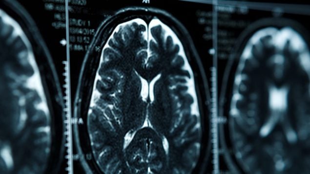 obesidad el trastorno por atracón