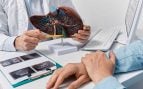 La prueba que ayuda a detectar la evolución del hígado graso