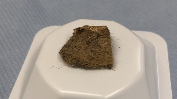 piel rinoceronte lanudo