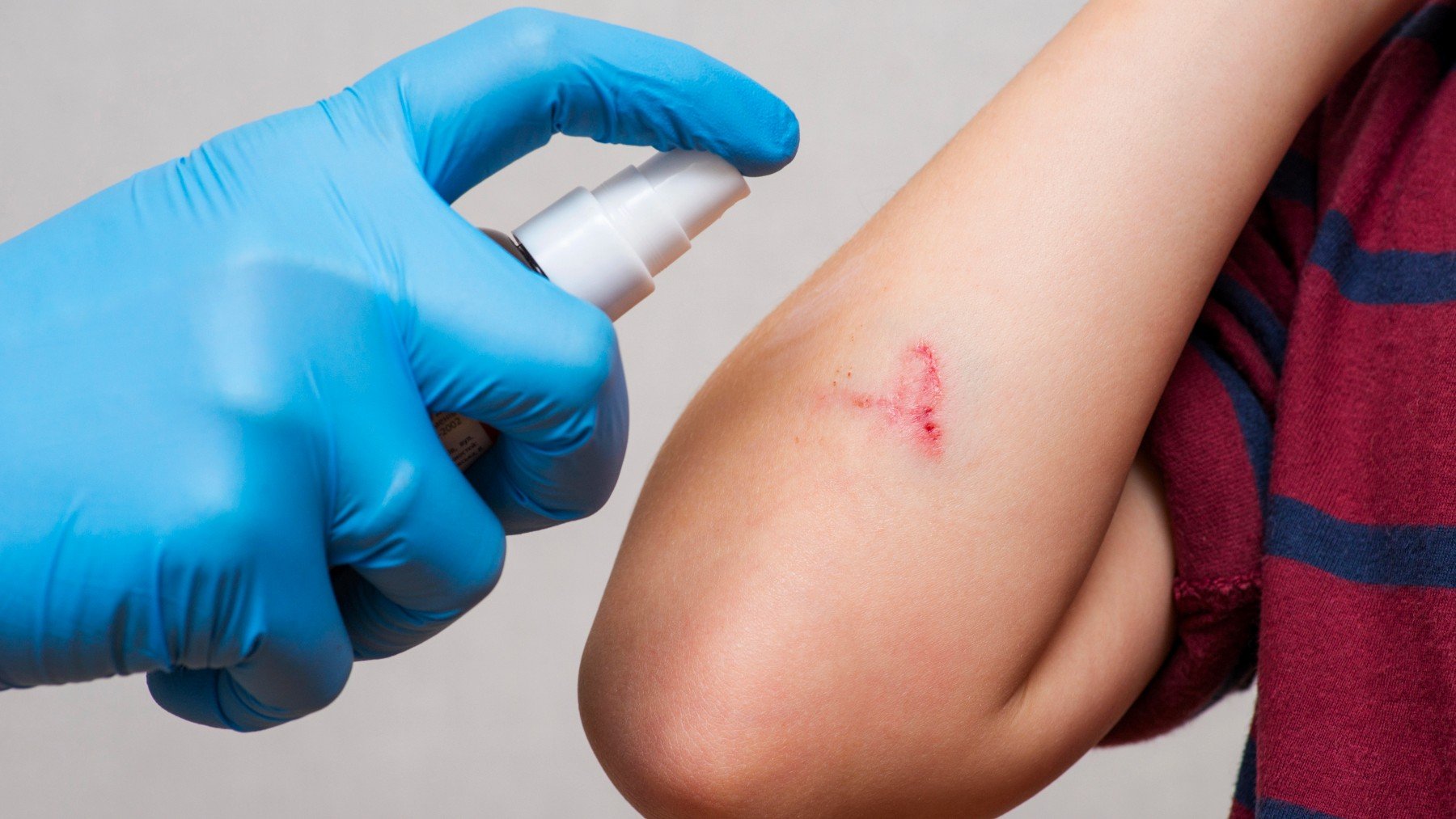 Así es el aerosol en polvo que es capaz de frenar hemorragias graves en segundos