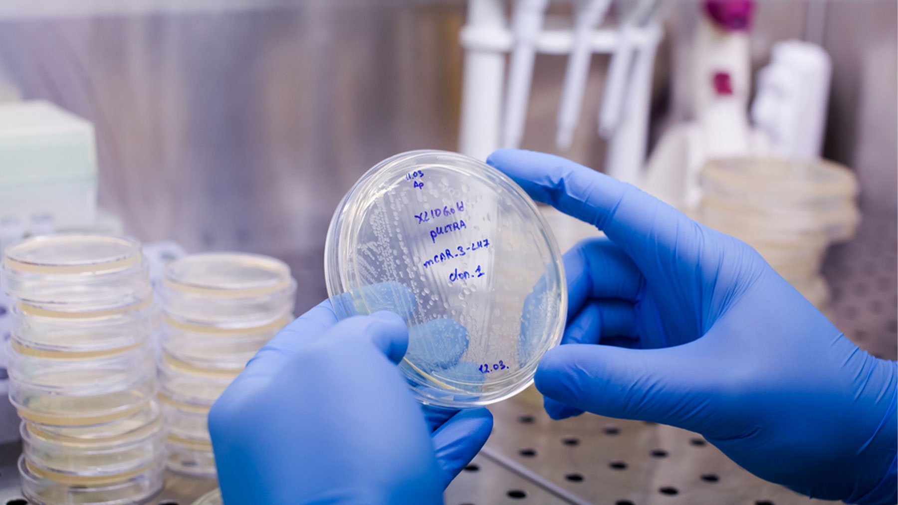 Terapias CAR-T de tercera generación: un relevo de las actuales pero con limitaciones