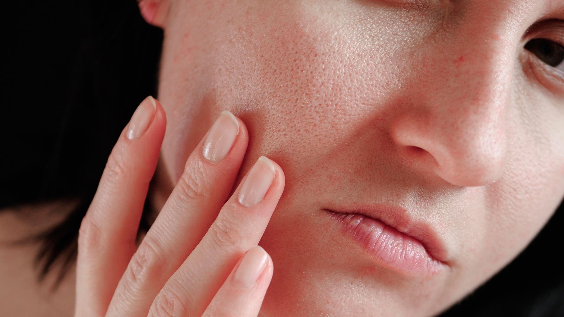 Ésta es la conexión entre la salud mental y los problemas de la piel