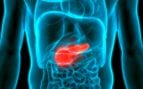 cáncer de páncreas