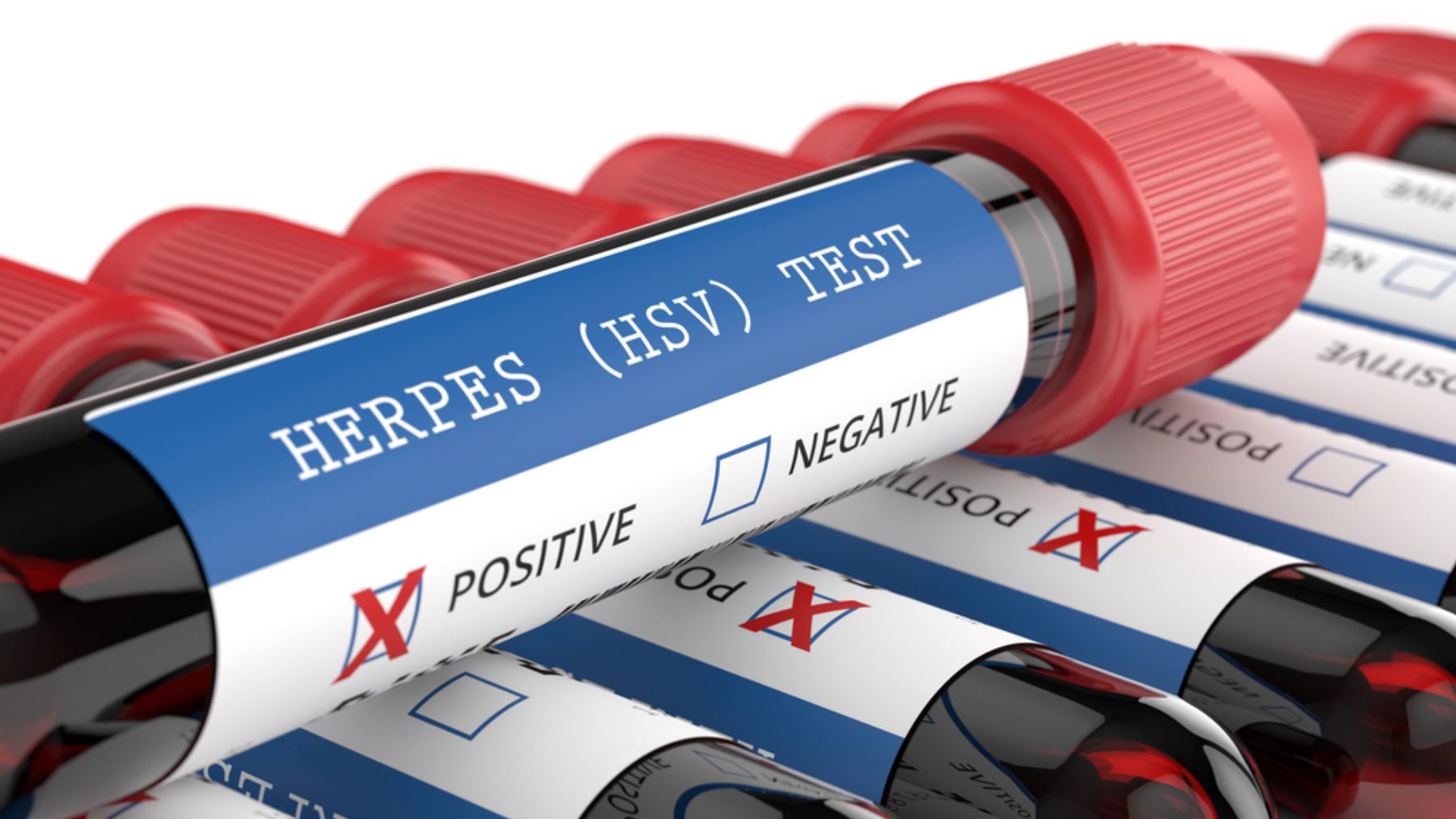 Herpes simple resistente: así funcionan los nuevos fármacos para combatirlo