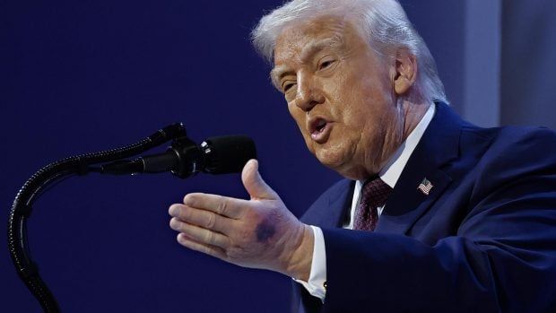 Trump insuficiencia venosa cr&oacute;nica