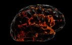 cerebro en llamas