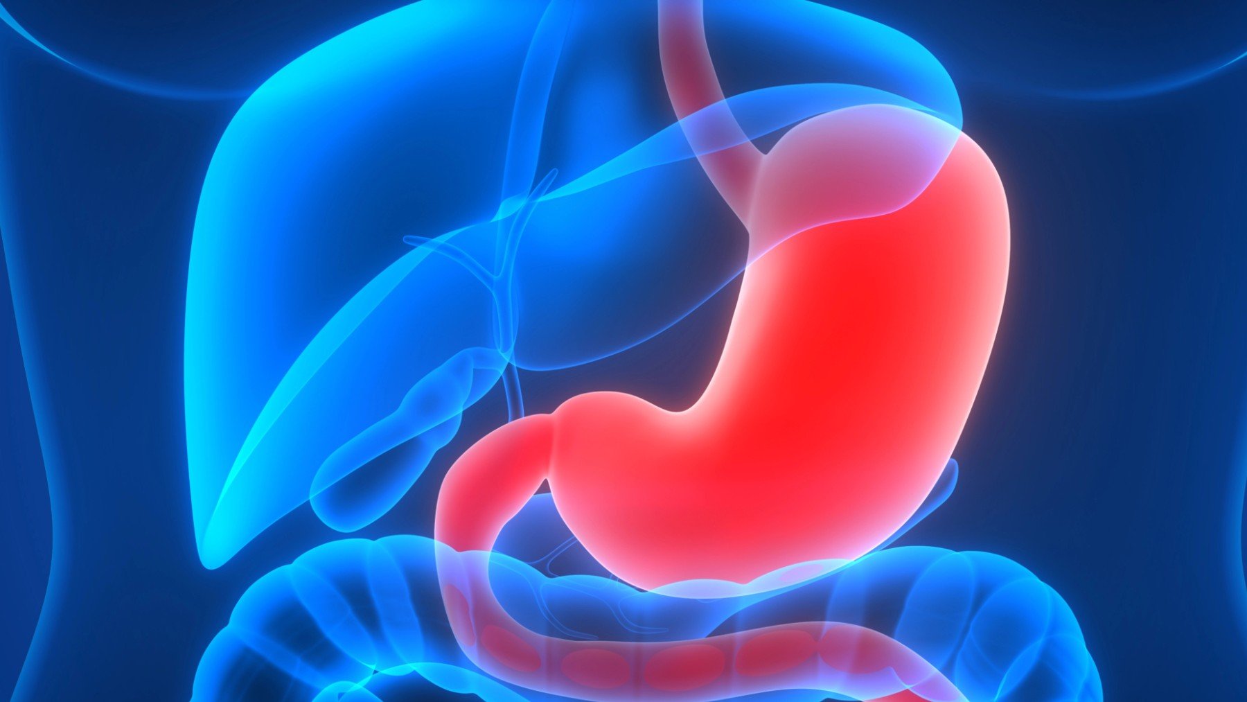 ¿Debemos preocuparnos por el uso de medicamentos contra el reflujo y el riesgo de cáncer gástrico?