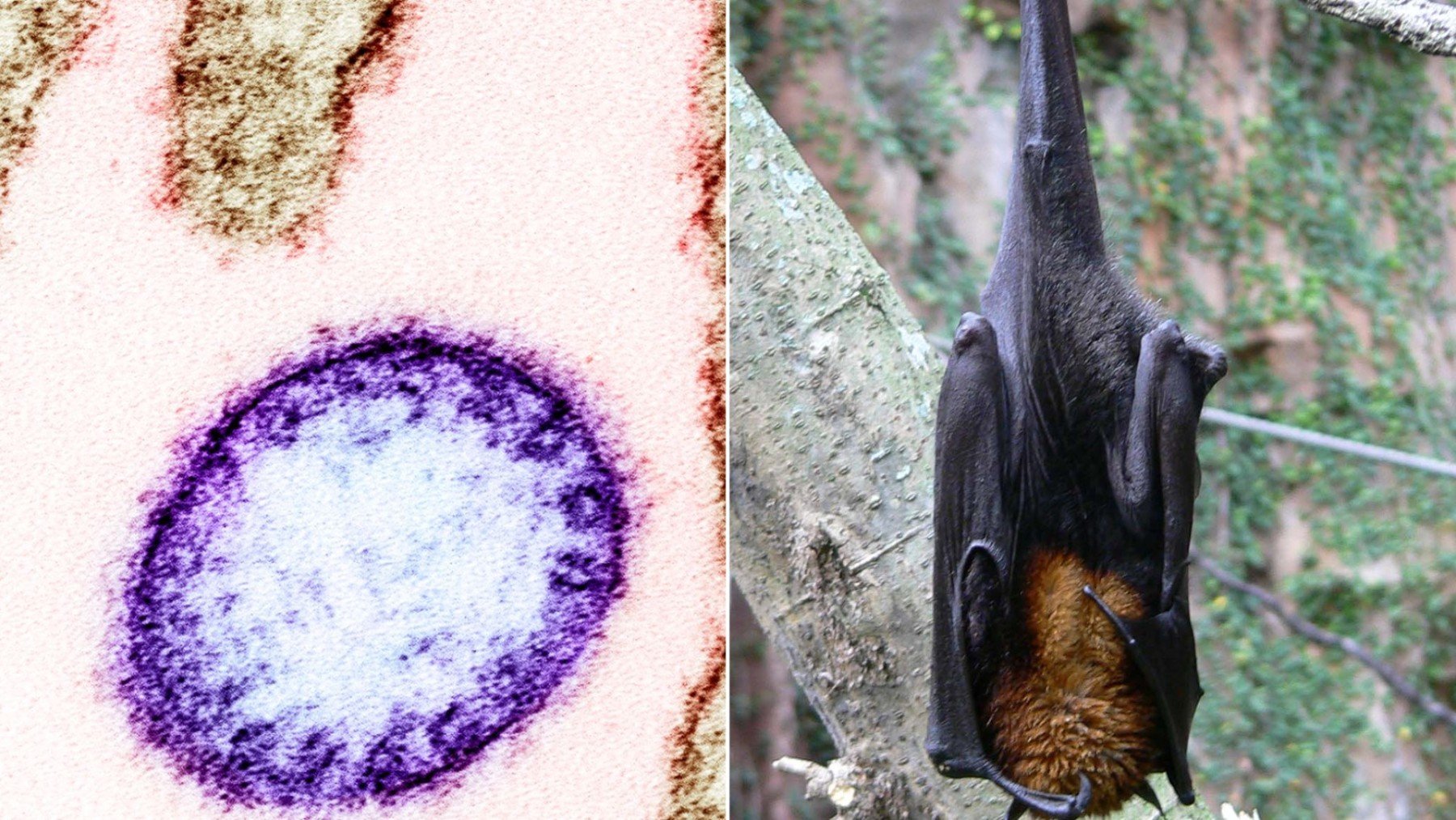 La OMS lanza una alerta por el virus Nipah en India ante el riesgo de una propagación mortal en Asia